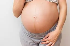 Abdominal Separation: What's normal in pregnancy?
