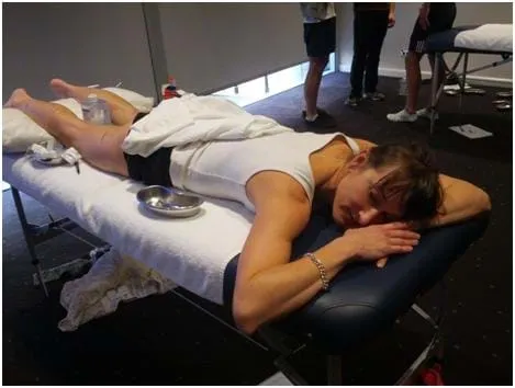 Dry needling and physiotherapy